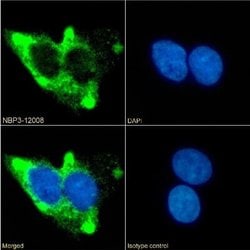 beta-2 Adrenergic R/ADRB2 Rabbit anti-Human, Clone: 13D6, Novus Biologicals 0.2 mg | Buy Online | Novus Biologicals | Fisher Scientific
